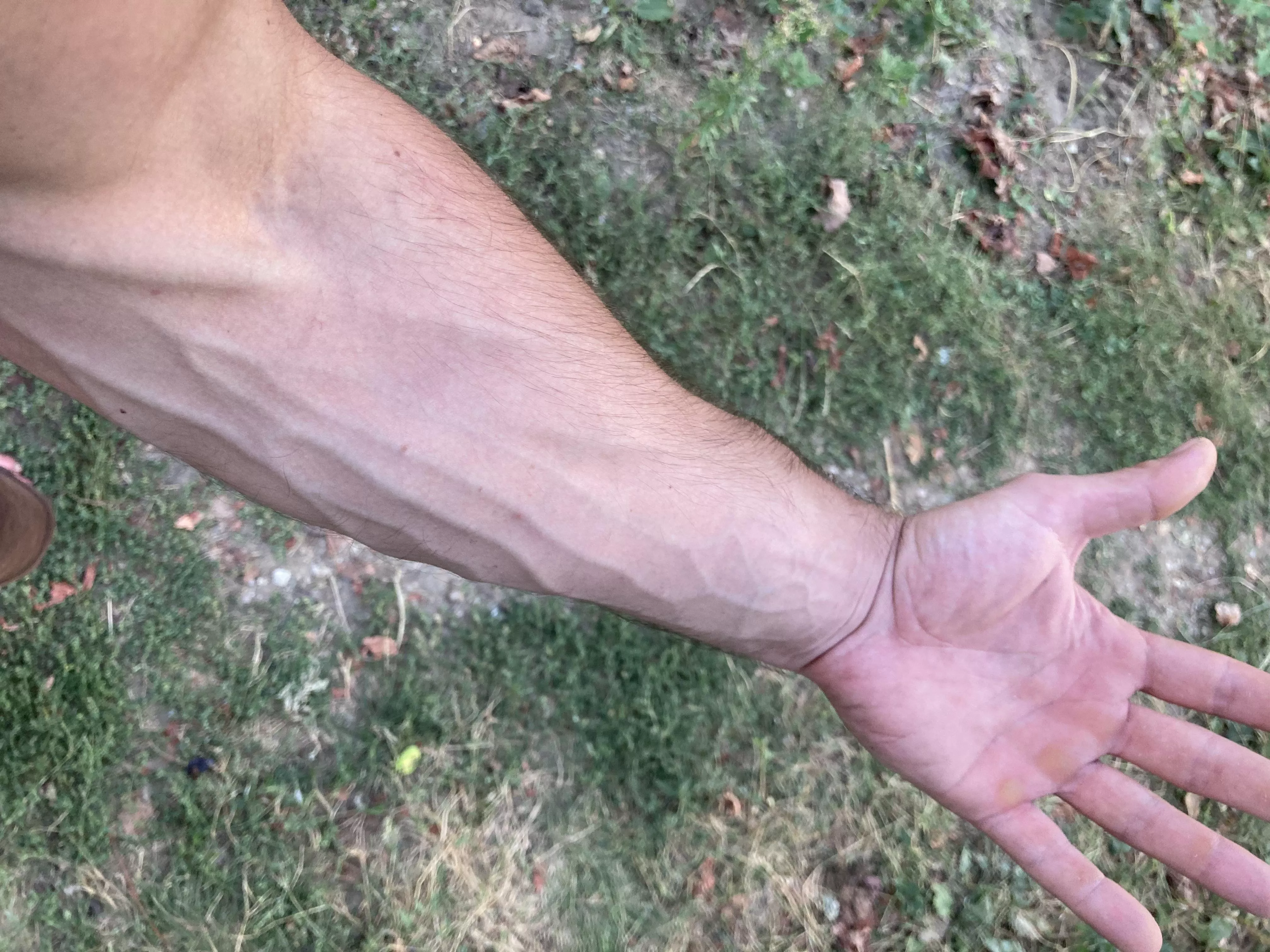 Someone said my hands are rejecting due to my calluses , are they right ?