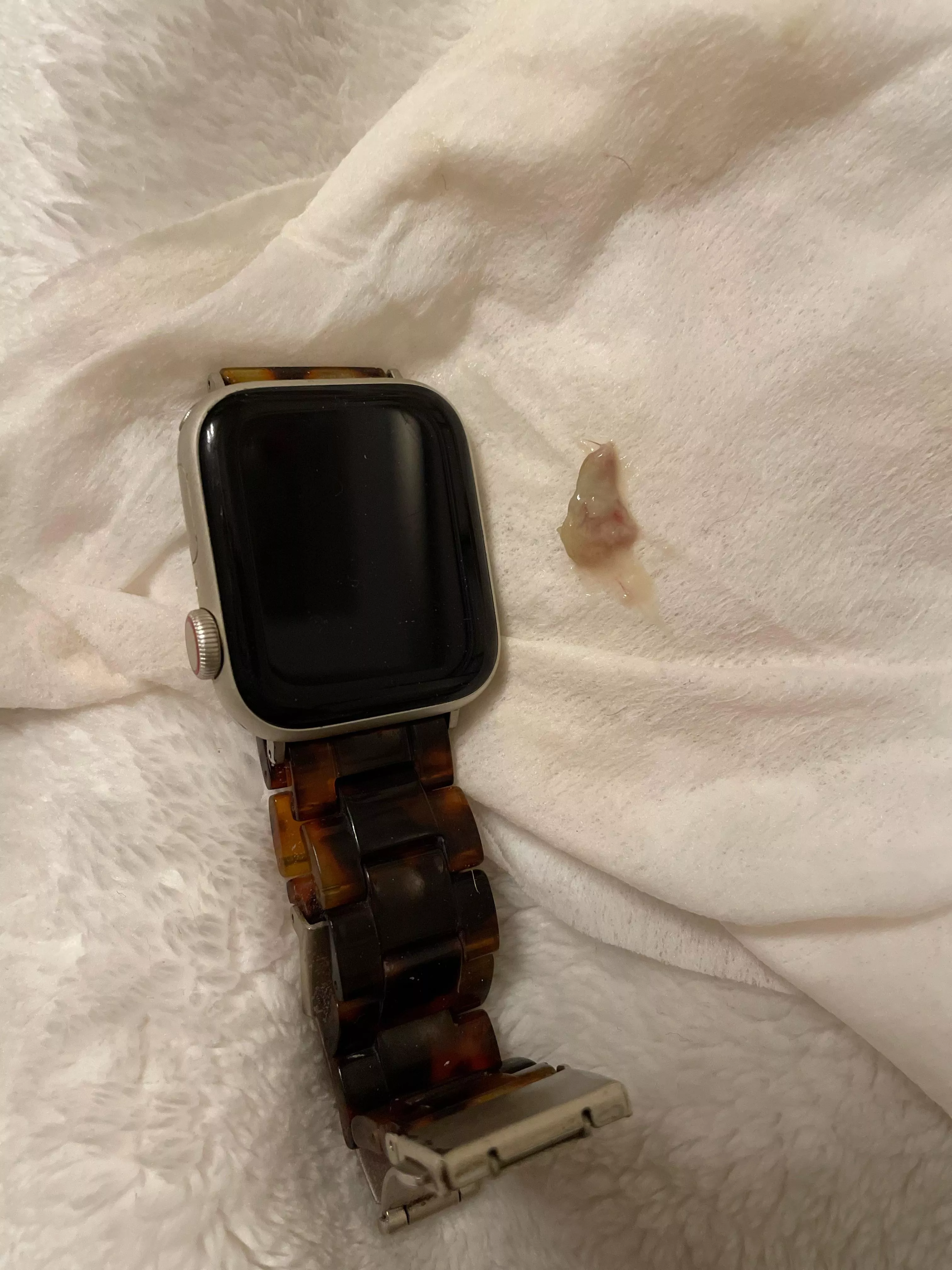 Sinus pop- Apple watch for scale