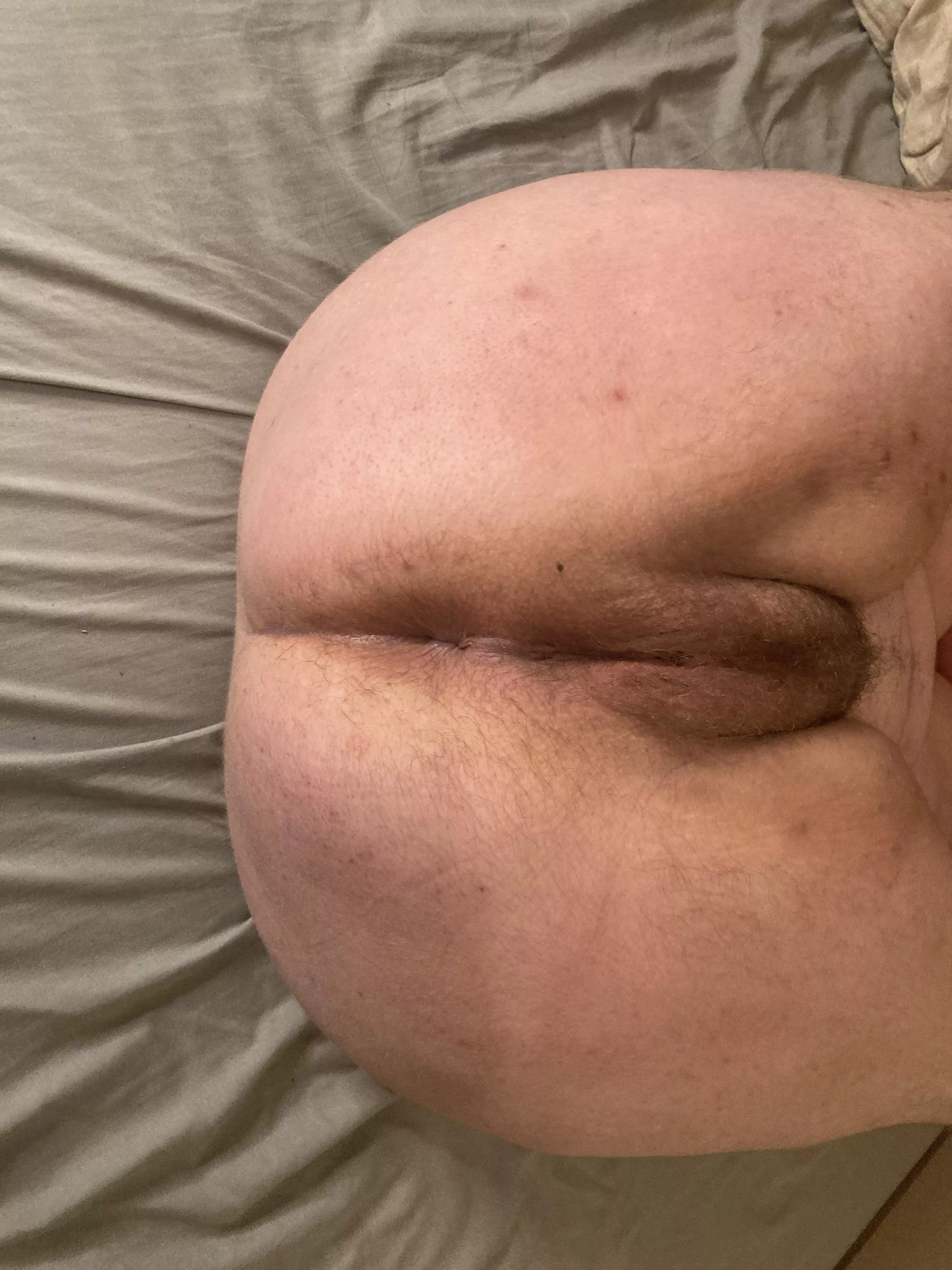 Hairy Holes and only getting [h]airier