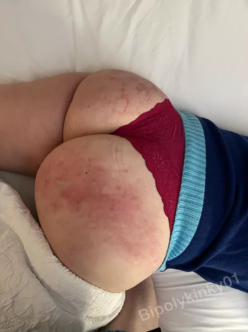 Could use some tender kisses after the spanking I just received