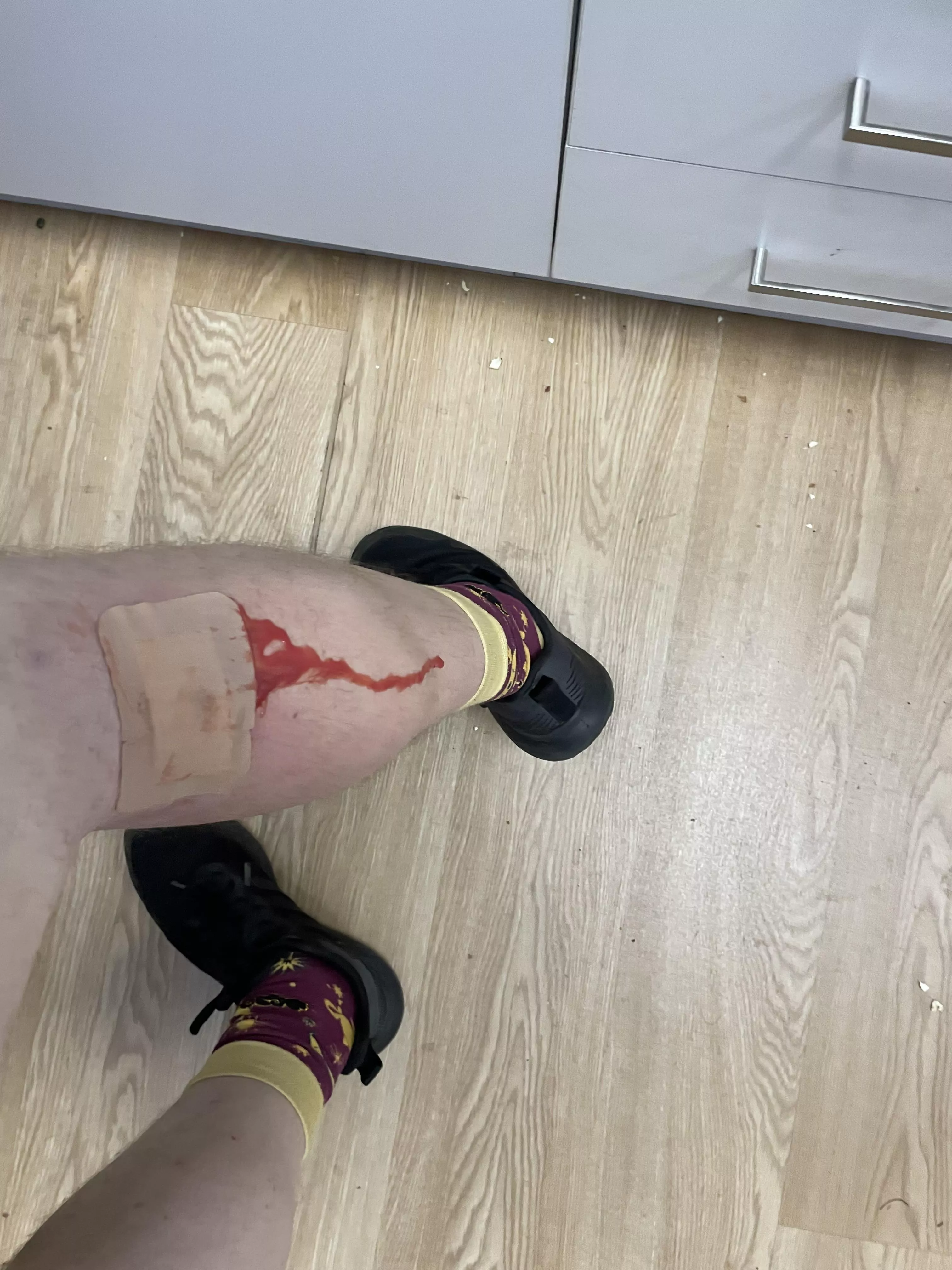 Finally a pus explosion