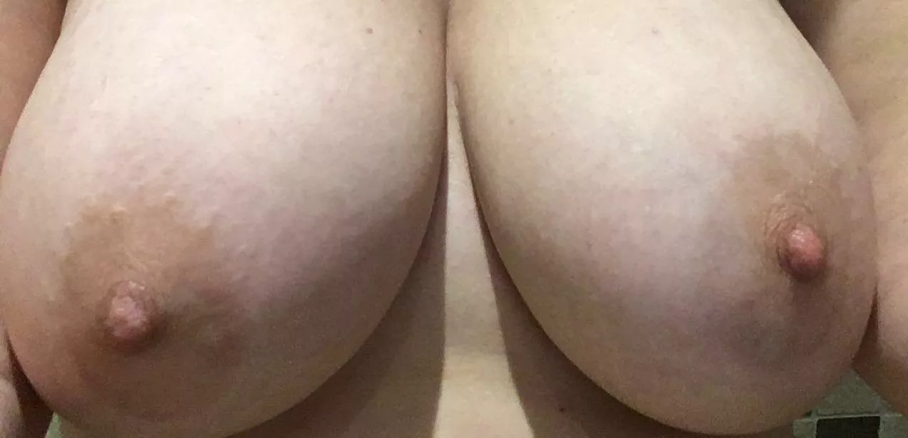 They might need some attention :)