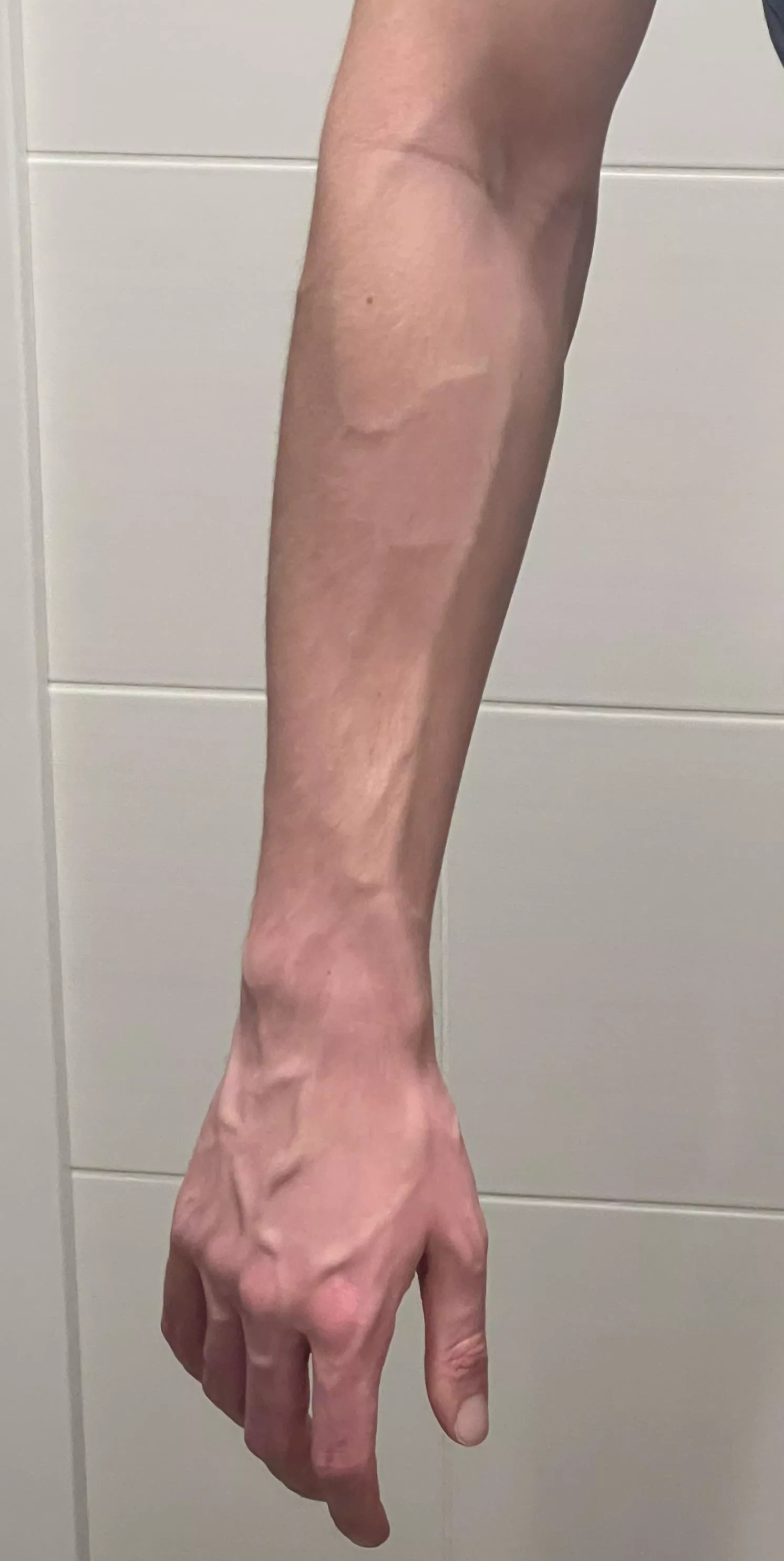 Just woke up like that