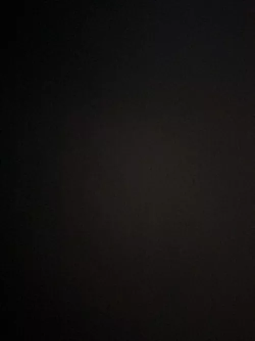 Doctor wanted to see my erect cock