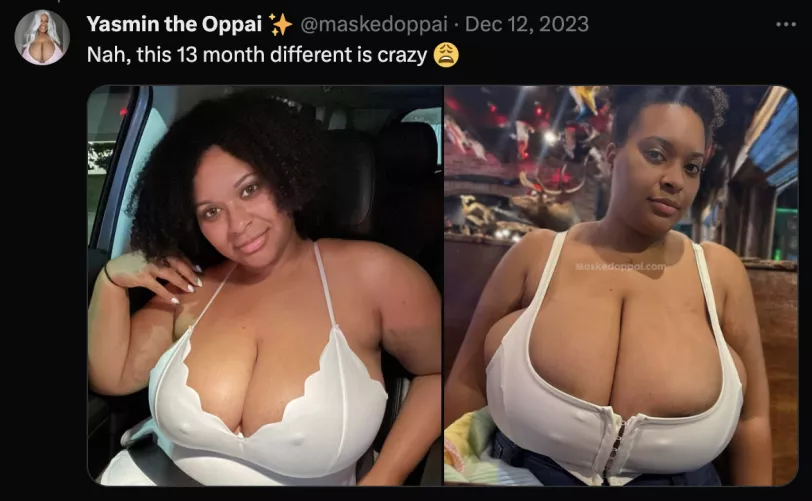 My first time posting here! (13 month difference due to weight gain)