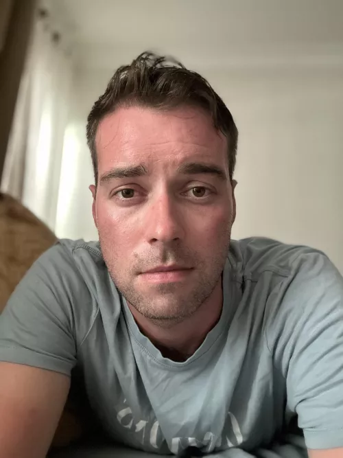 Sunburn sucks.