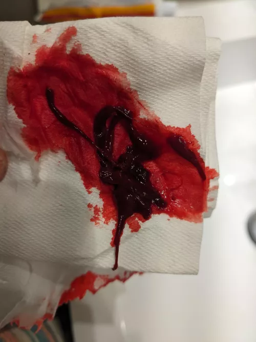 Dopeass clot (so blood, obvs)