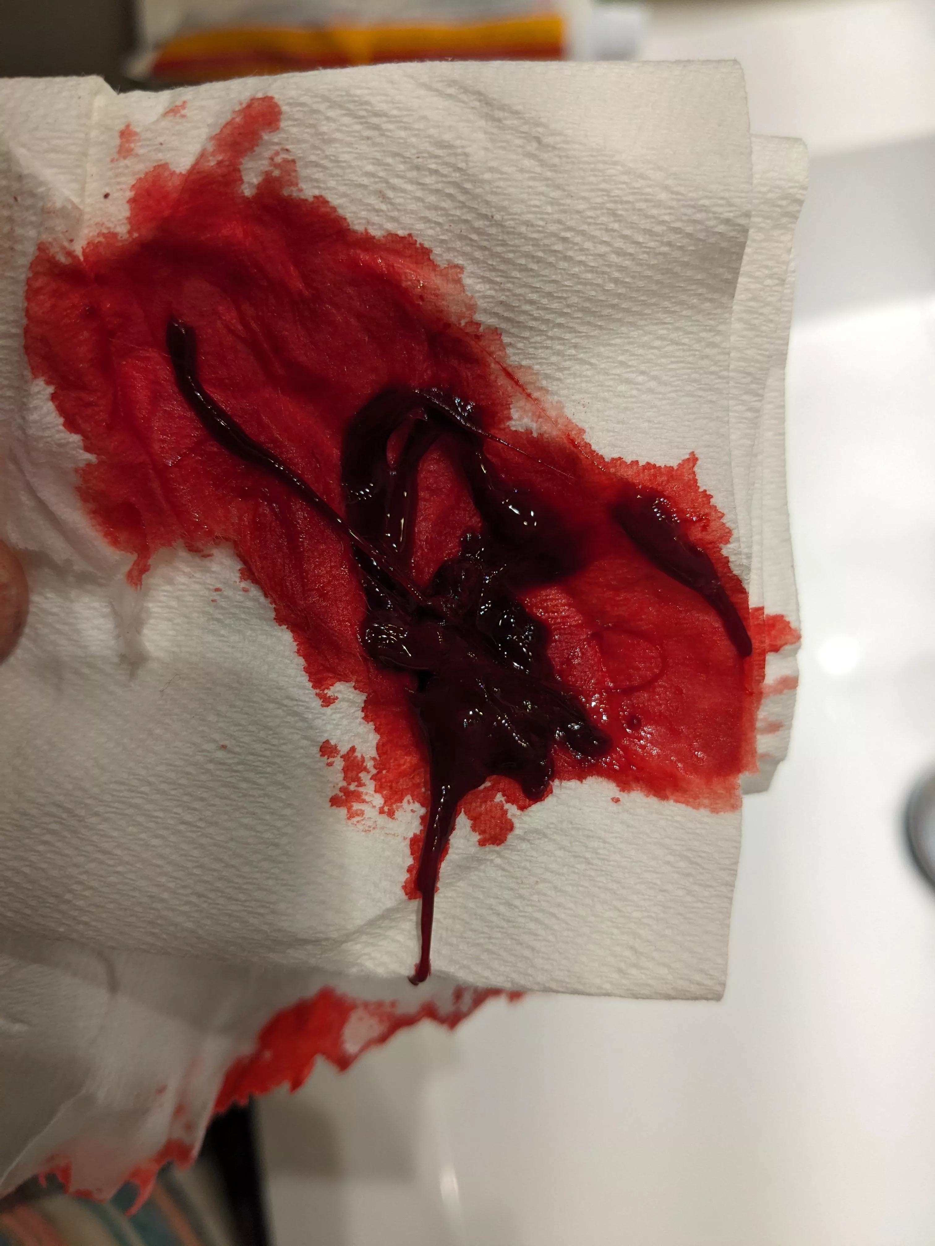 Dopeass clot (so blood, obvs)