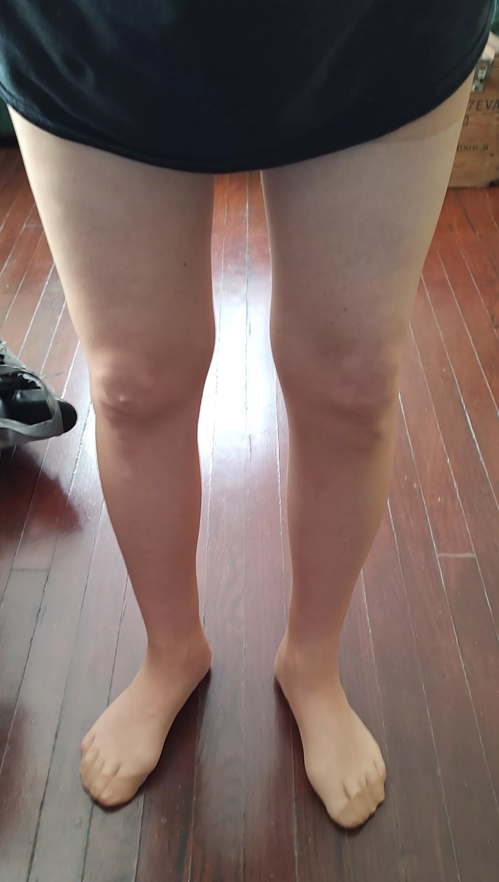 I think my feet look ok for (58)