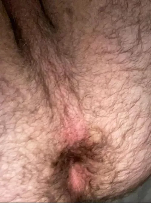 Is my hole to hairy?