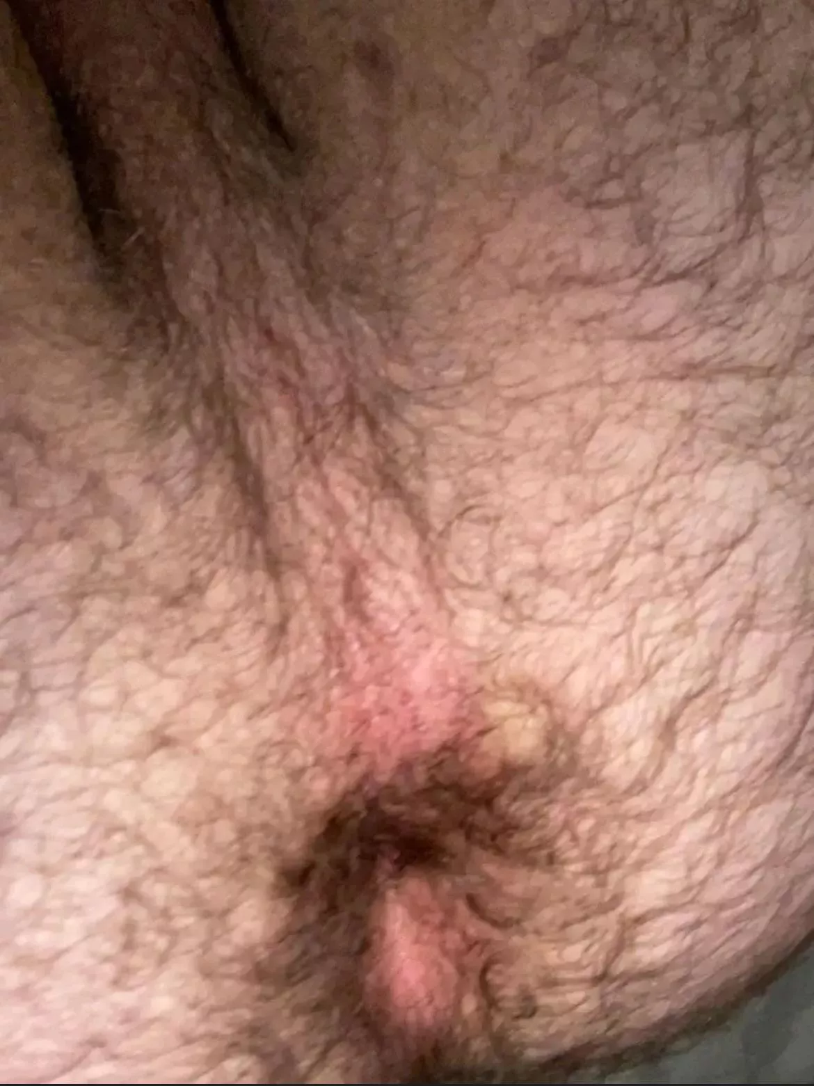 Is my hole to hairy?