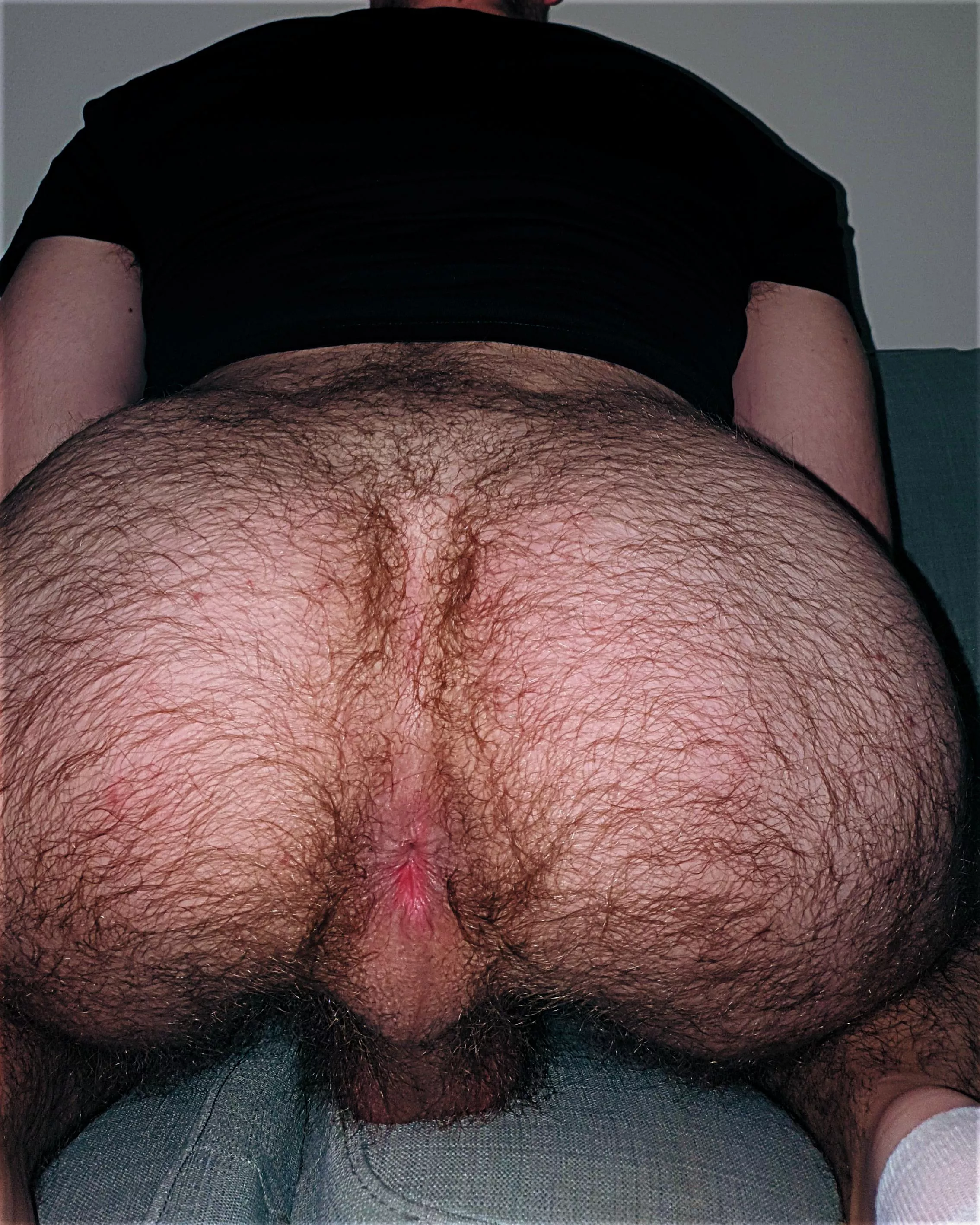 Should I embrace my hairy ass?