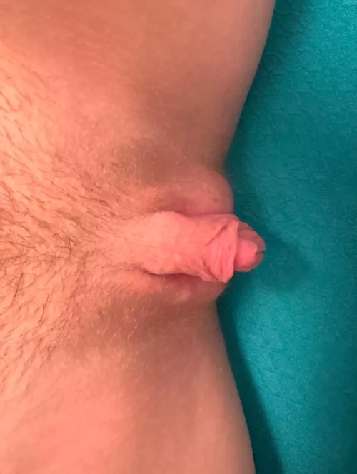 What happens when I’m all swollen?