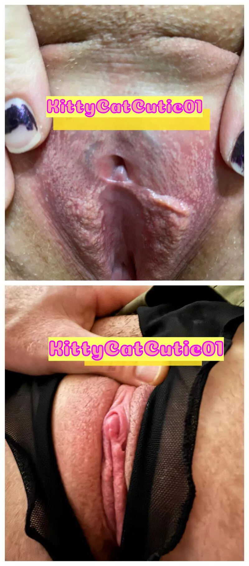 5 month Before and after clit growth