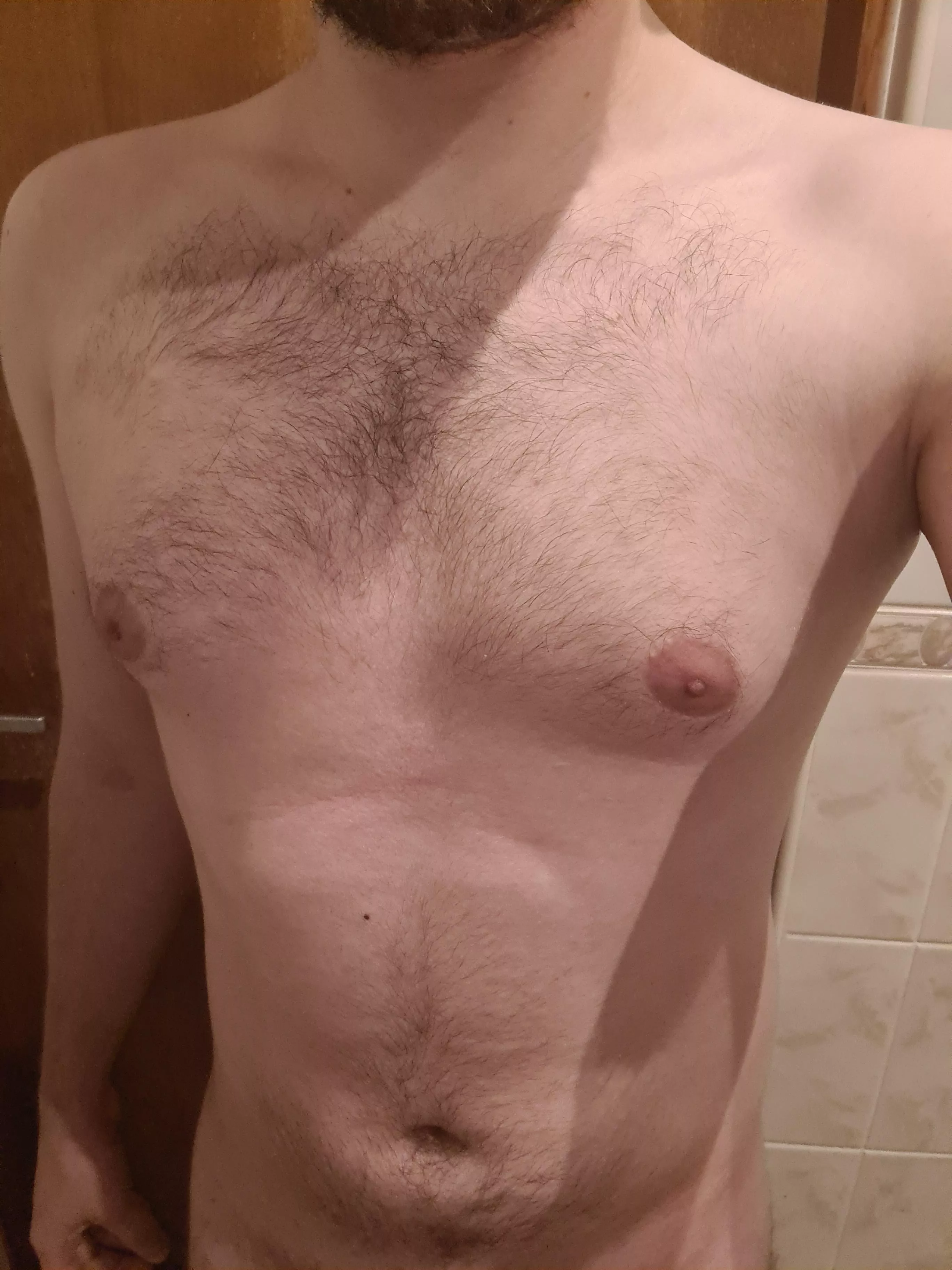 Am I to hairy for a teen