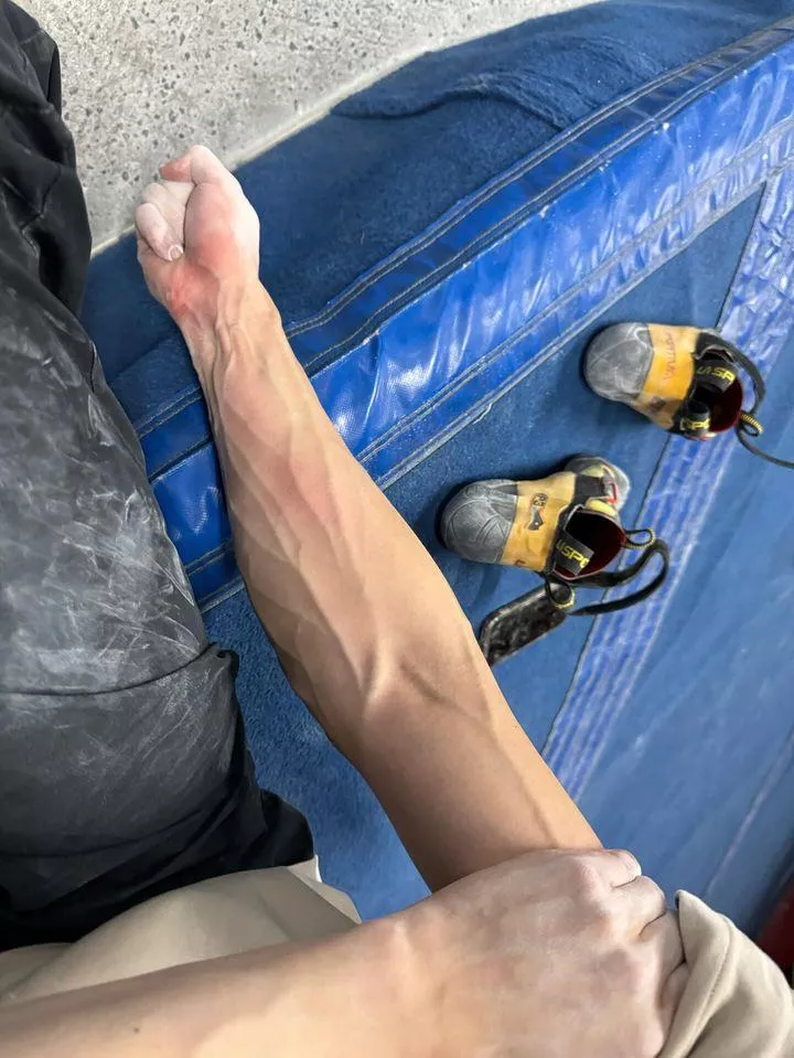 👀 lil bit of veins