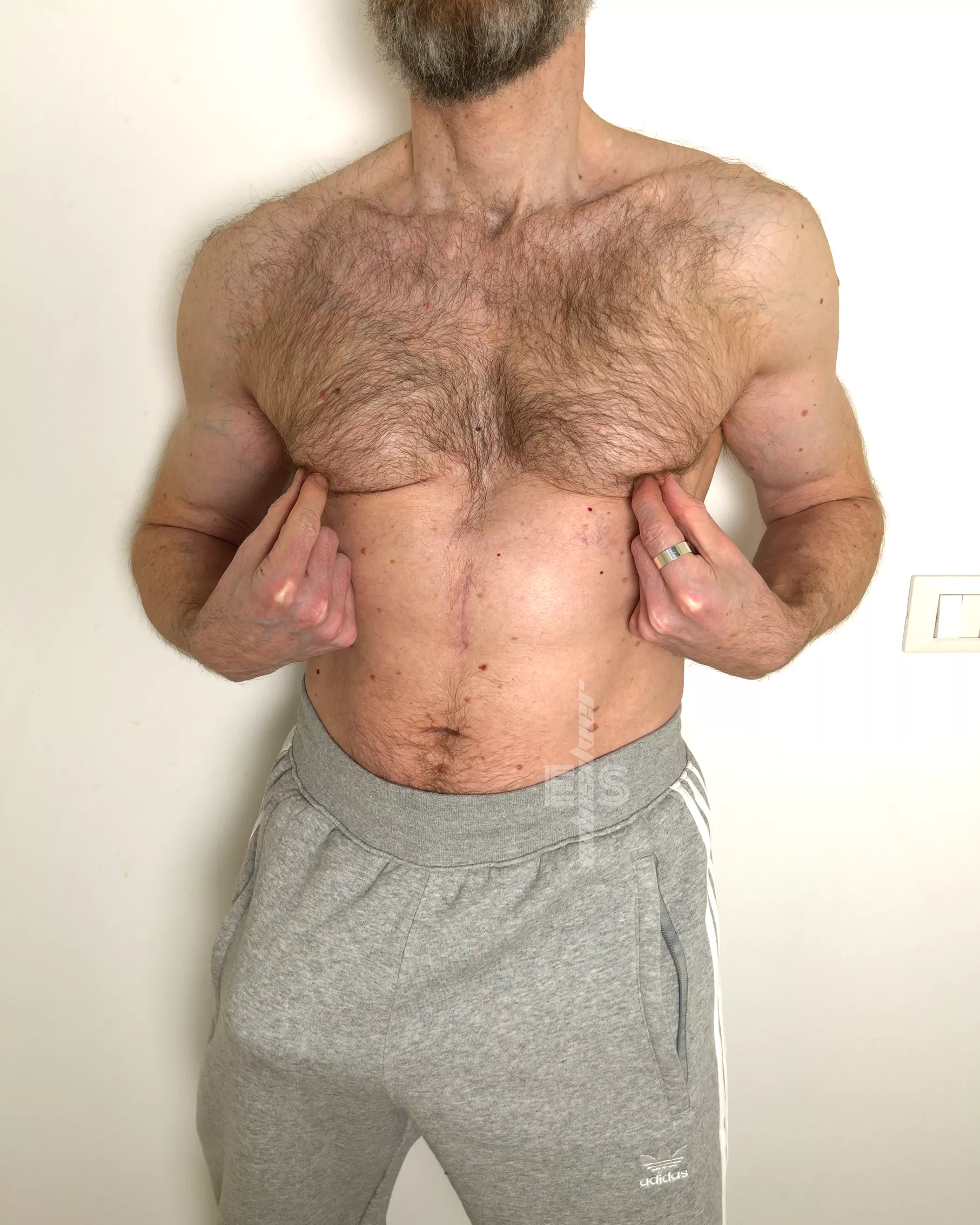 Oops! Is this what you would call a wardrobe malfunction?