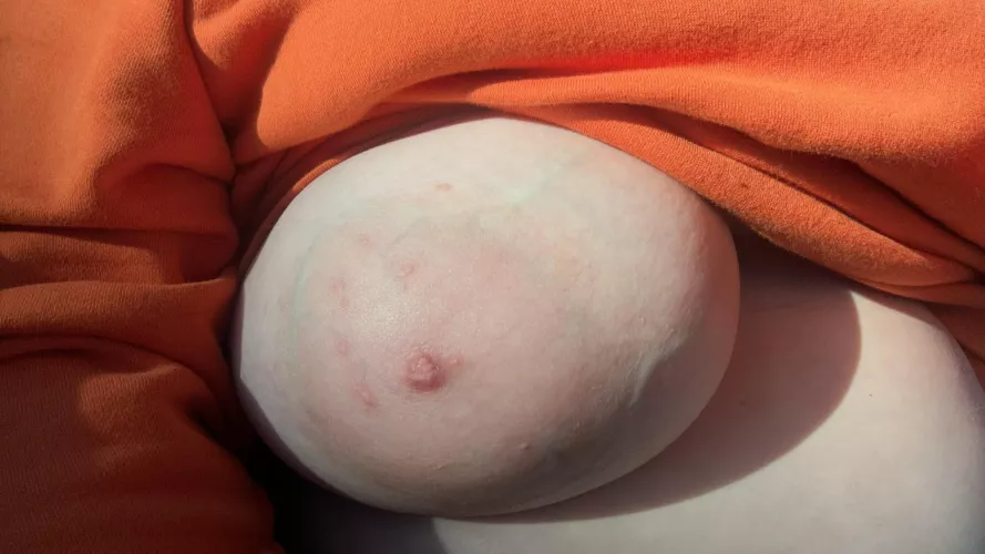 She needed a little sunlight