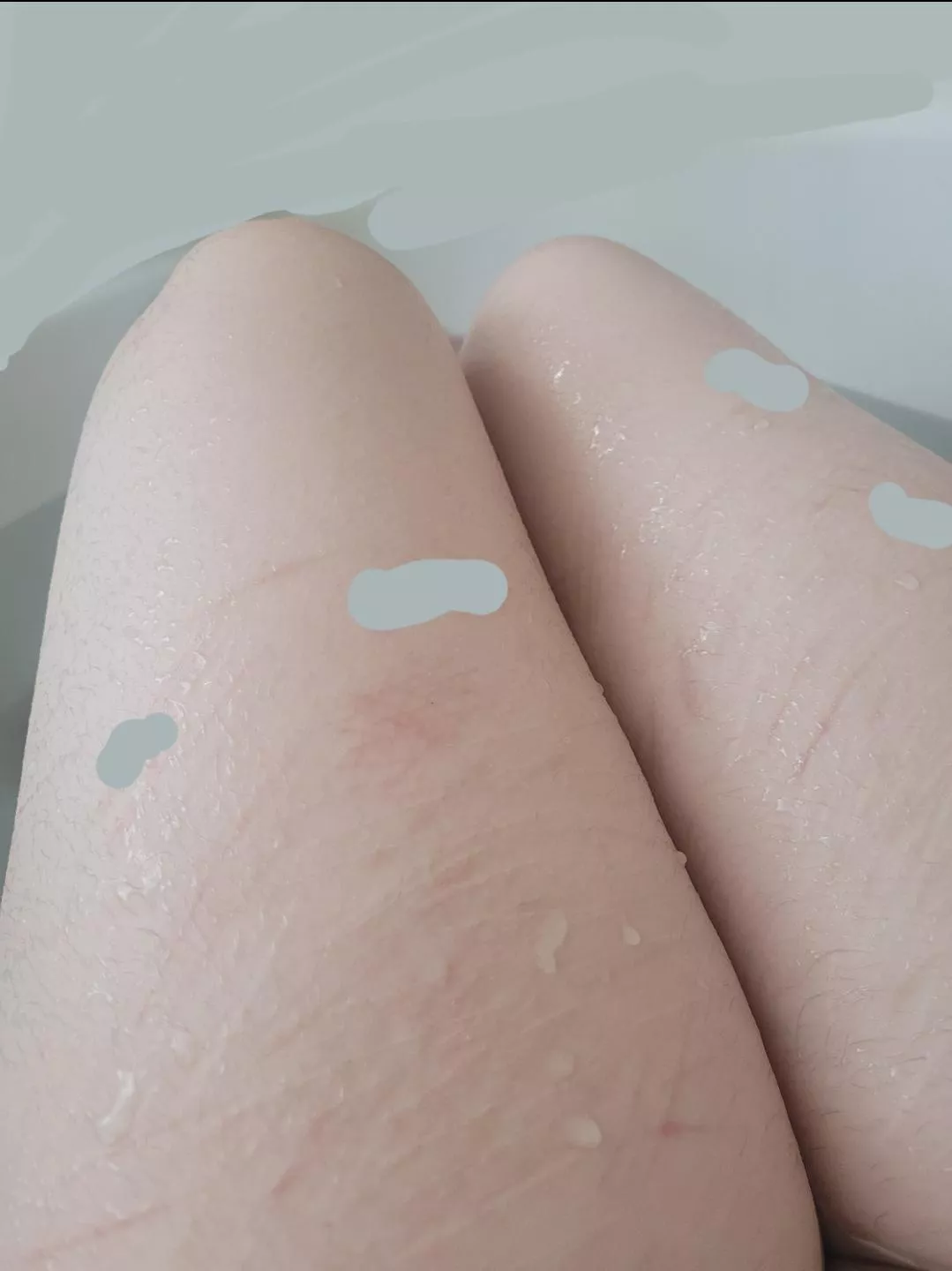 tw scars - had a nice lil bath today :3c