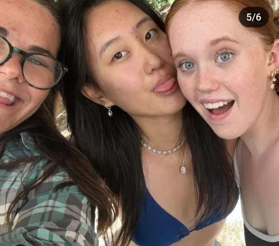 White, asian or ginger? Which one? [3]