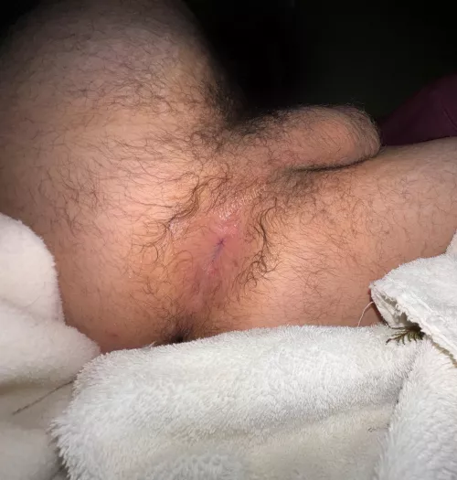 i need some attention