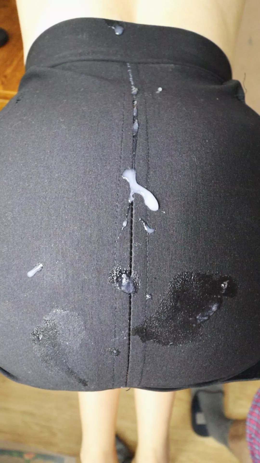 White spots are FOREVER!