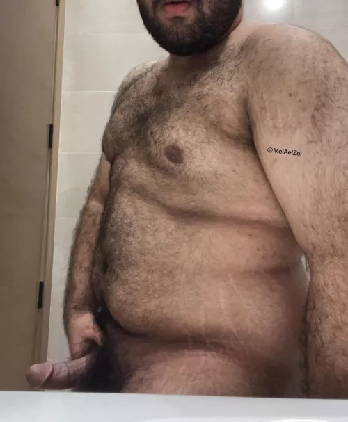 (21) are my stretch marks unattractive?