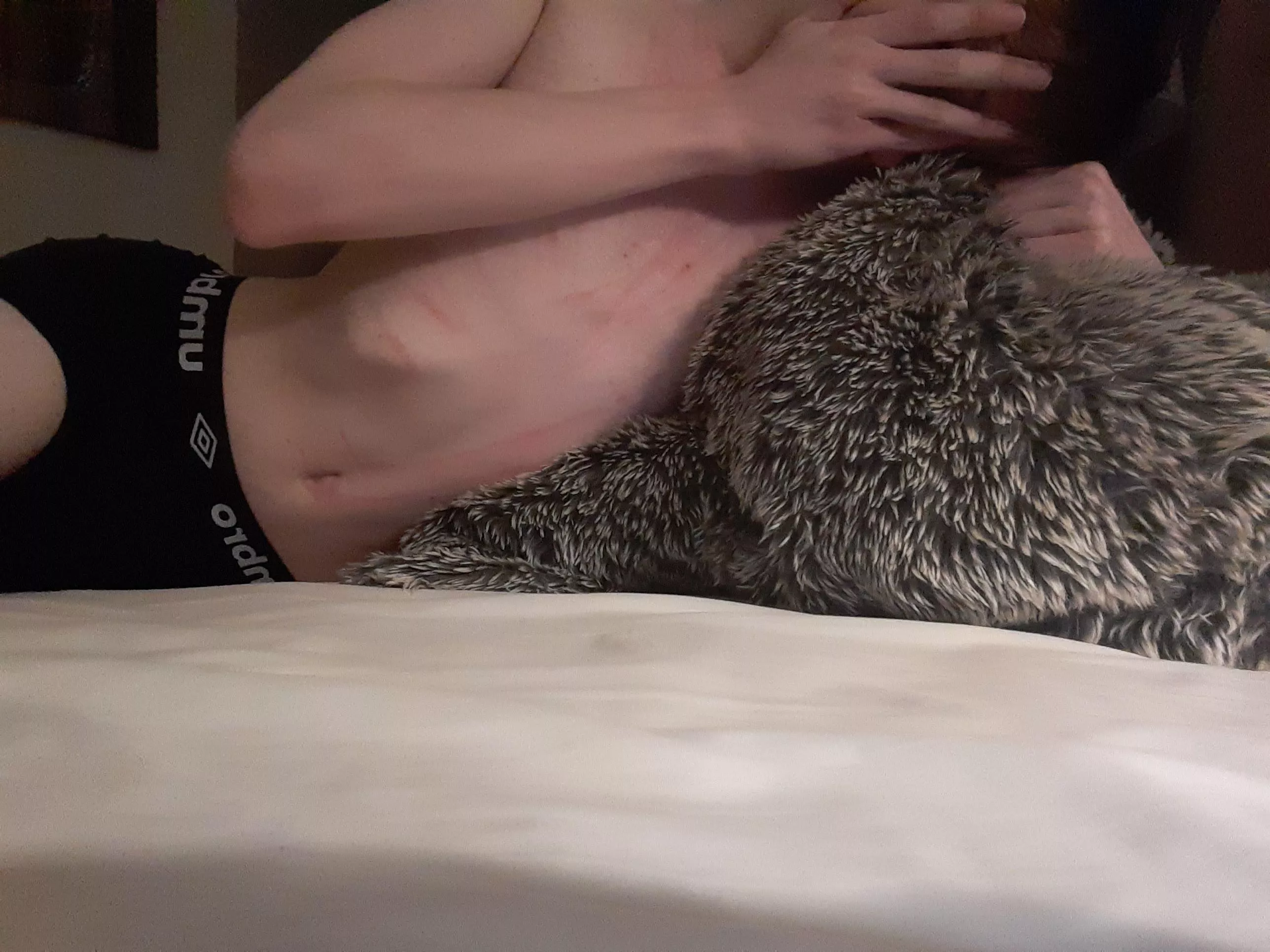 I SOOO wish i had a mommy to scratch me up like this..>< mark me?