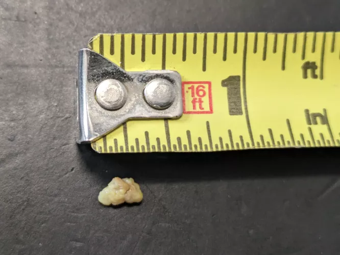 Just coughed up this monster