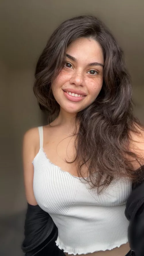 Pokies or freckles, what’s getting your attention first?