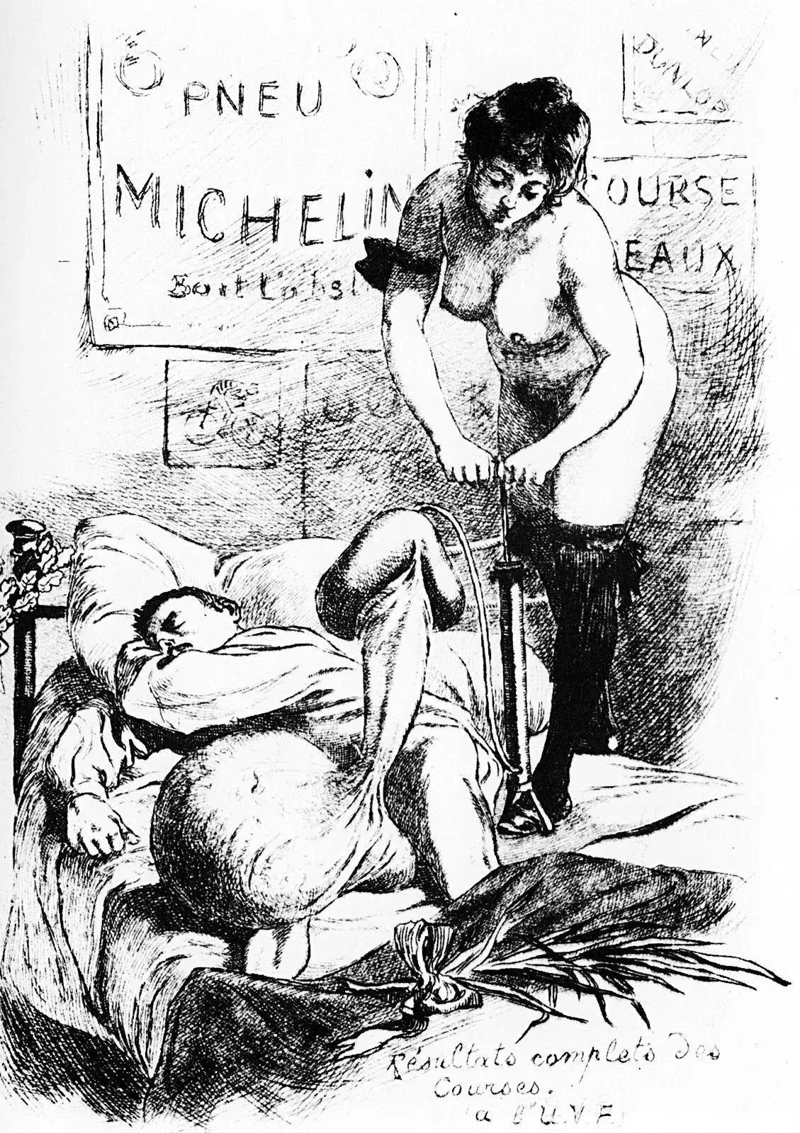 Sir, I enclose a magic lantern slide from a lecture at the Royal College of Surgeons. It illustrates the latest treatment that Gussie Herbert may need on his return.