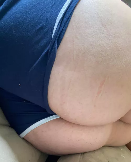 Woke up with a huge wedgie this morning!