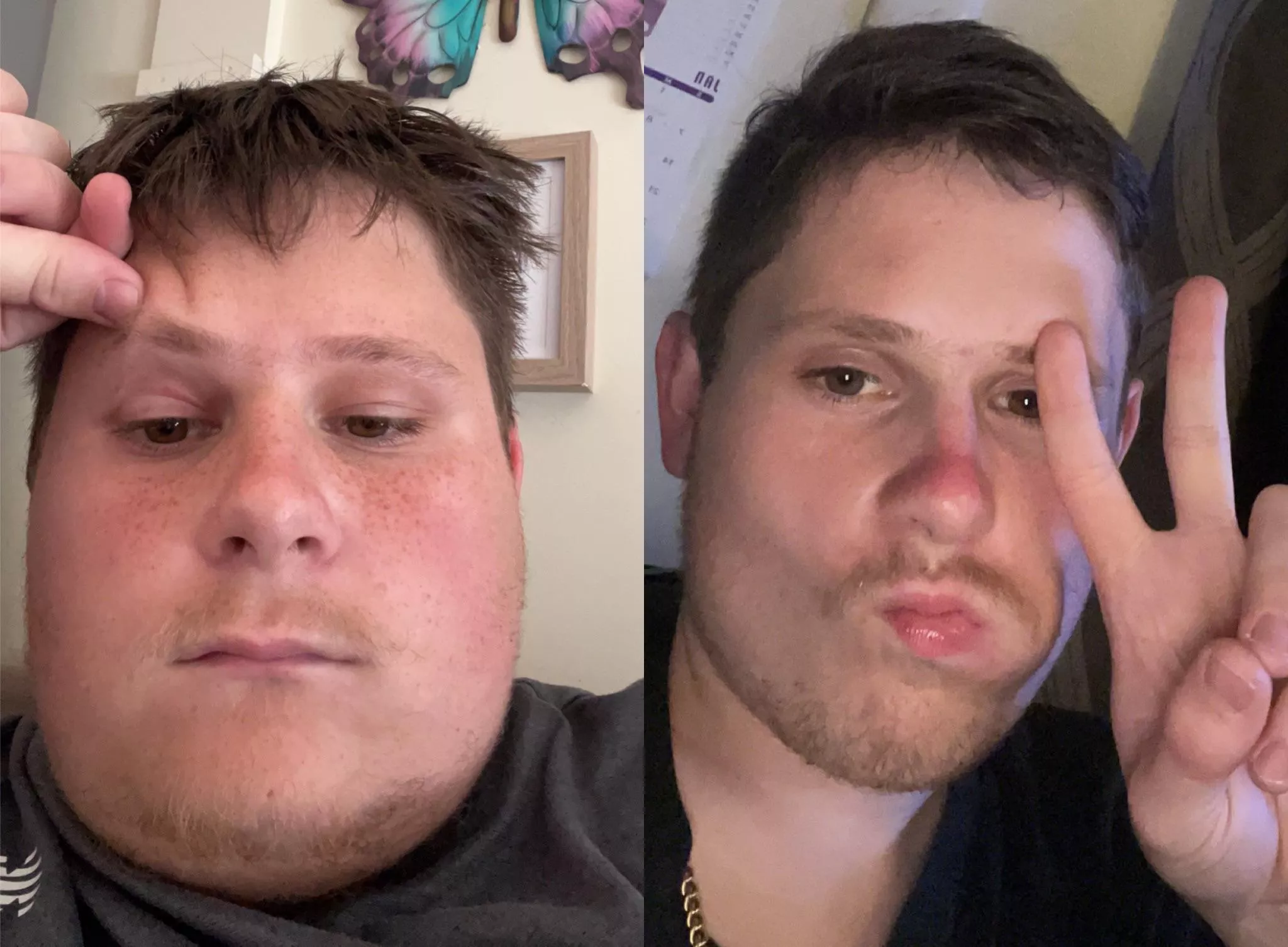 Before and after weight loss