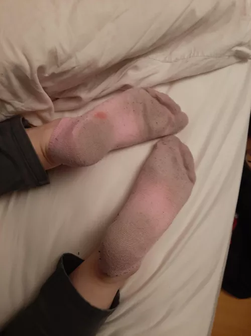 Crusty smelly soles🥰
