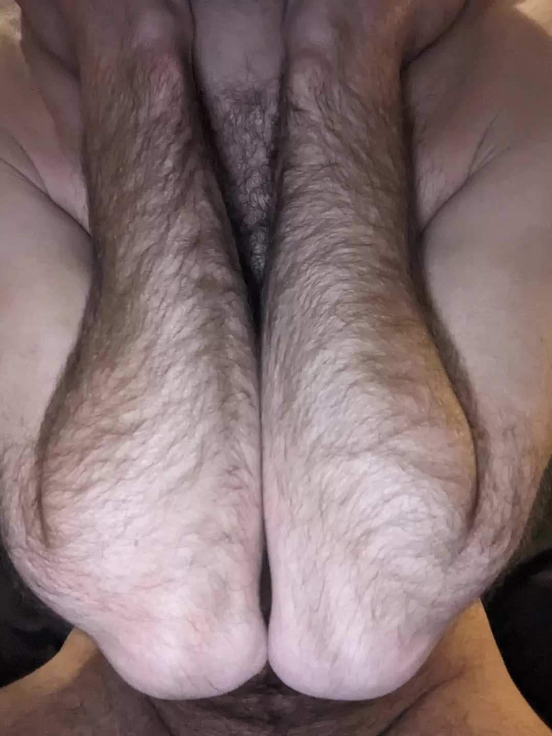 Hairy and skinny