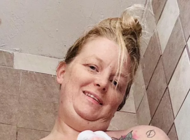 [Irtr] freckles all over