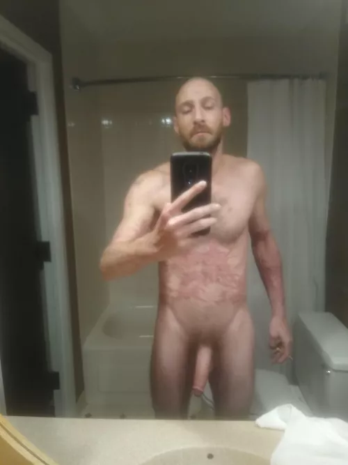 (m)41 do you like my scars