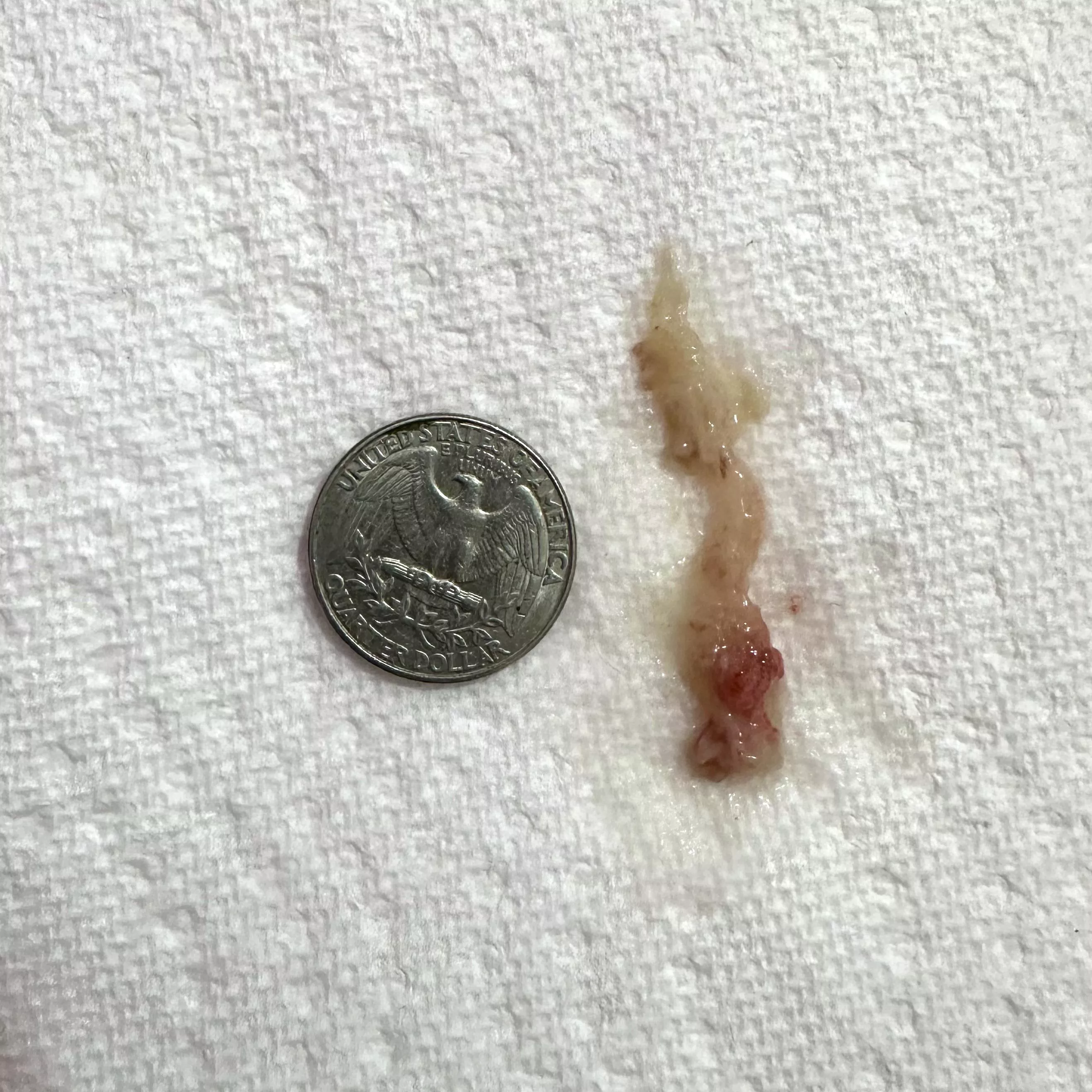 Sneezed huge nasal mucus plug. Been sick for days, such a relief to breathe again