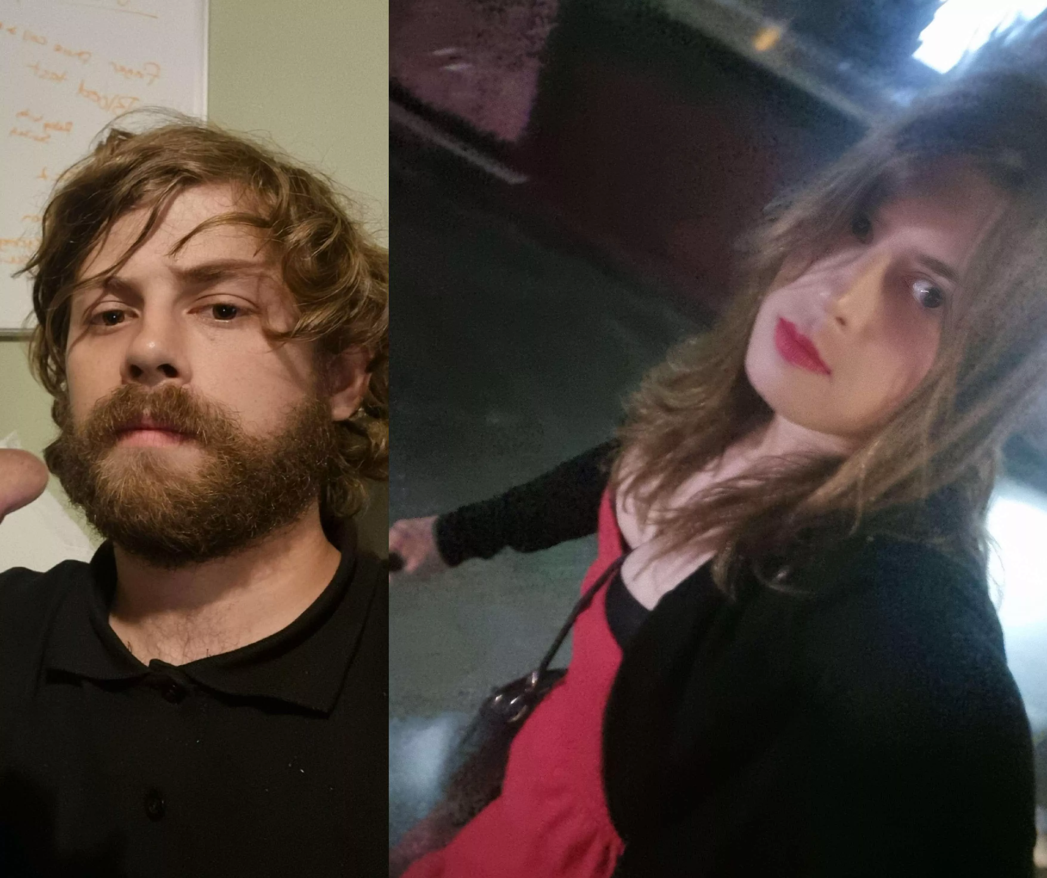 10 months hrt (28 Years old)