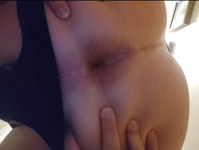 Hidden grower, spreading shower