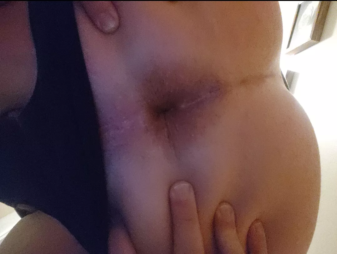 Hidden grower, spreading shower