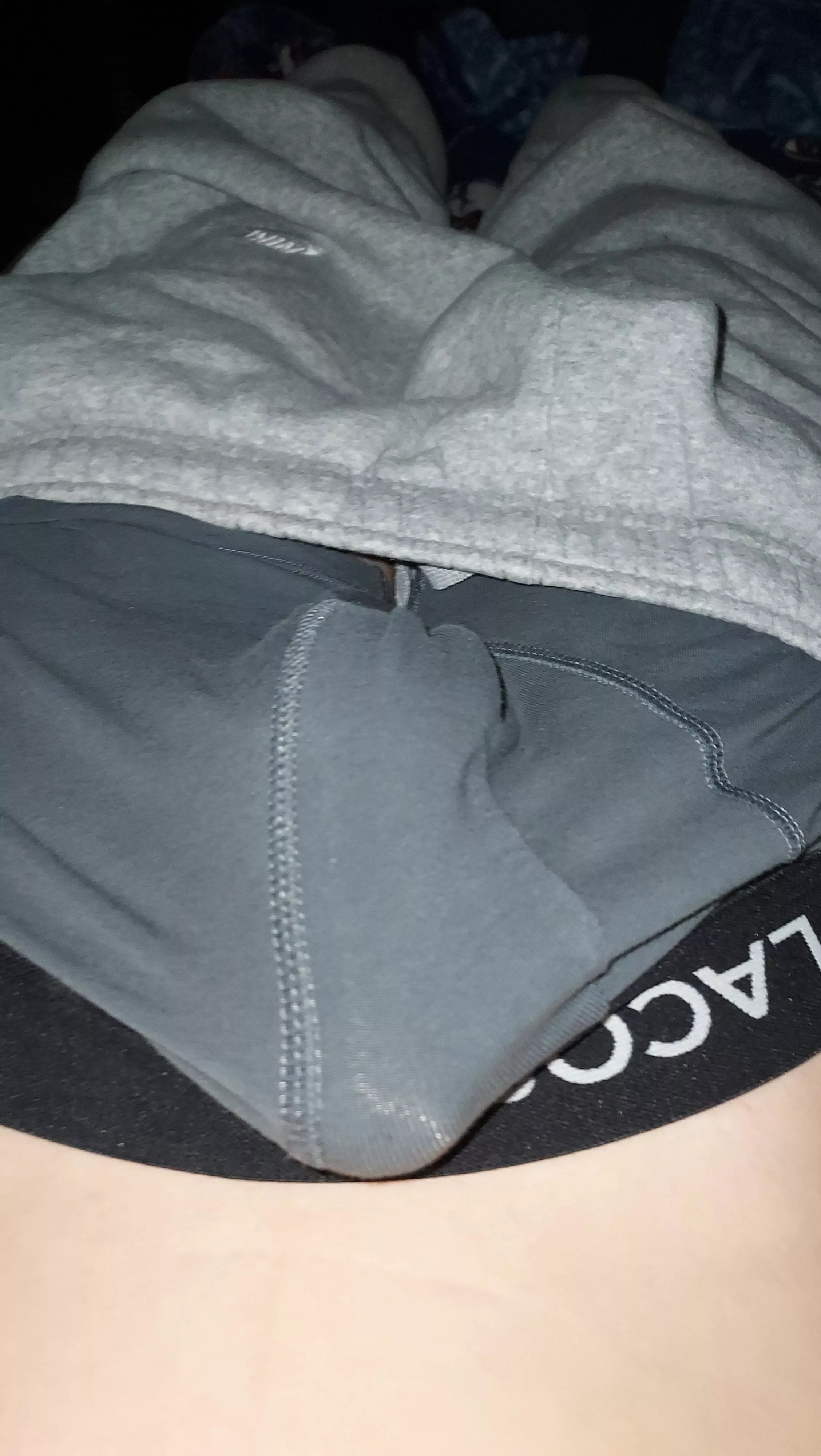 (M) does anyone wanna see what's underneath.
