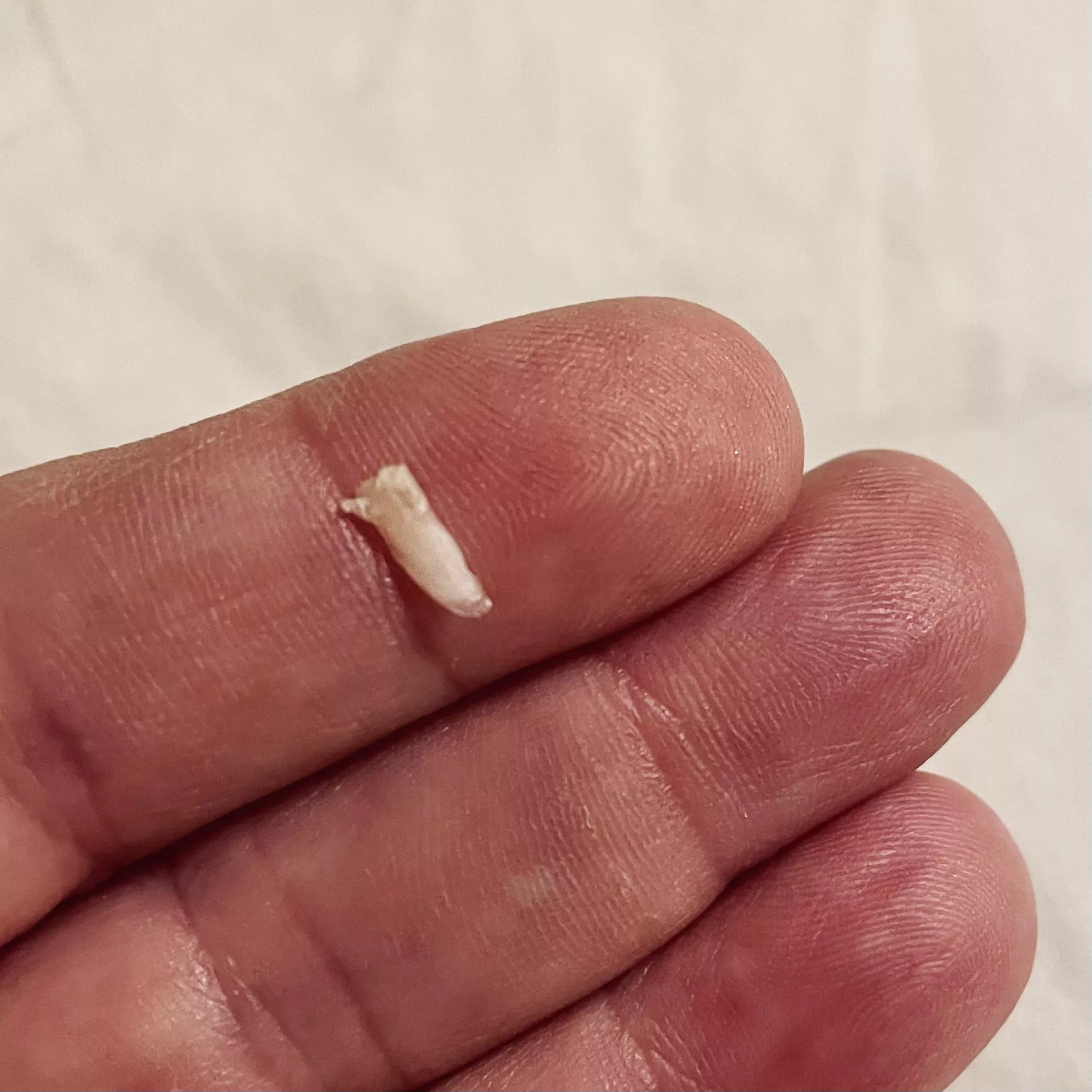 Popped out the extra sliver of toenail tonight