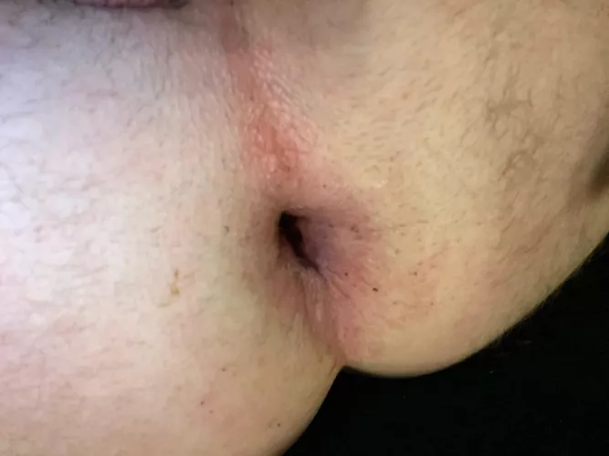 Think you can gape me more pop up 😘