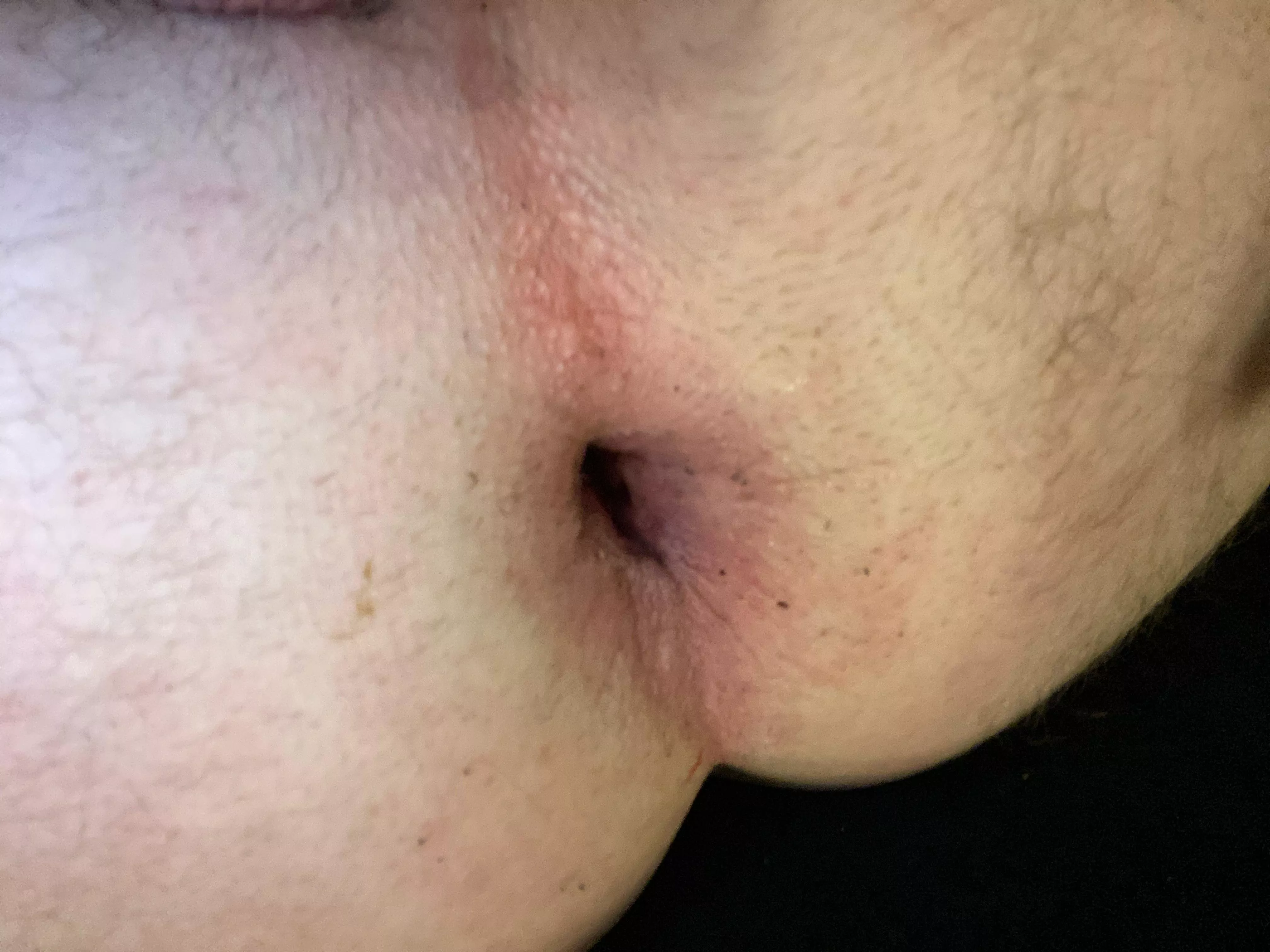 Think you can gape me more pop up 😘