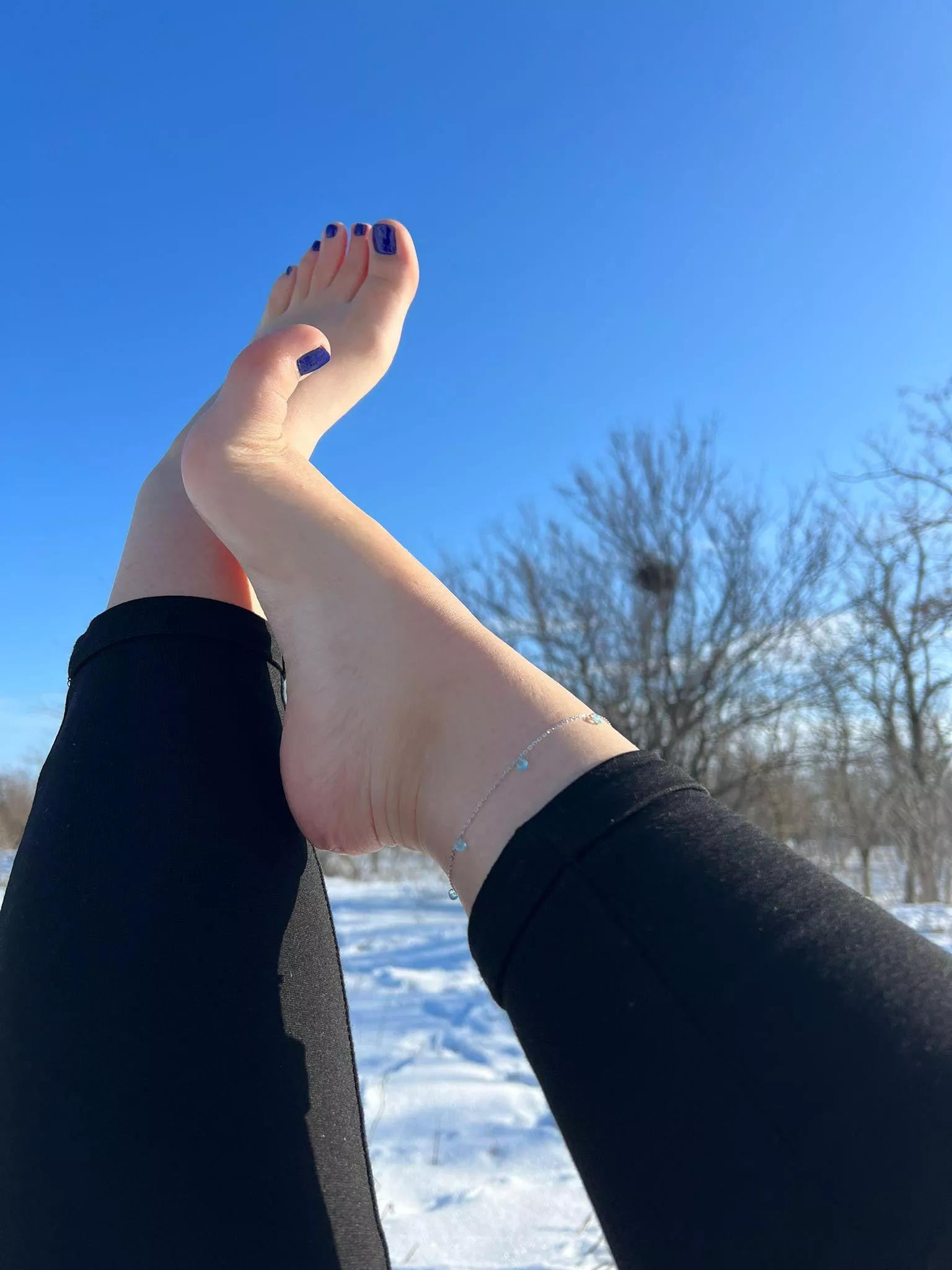 Are my feet Yay or nay ???