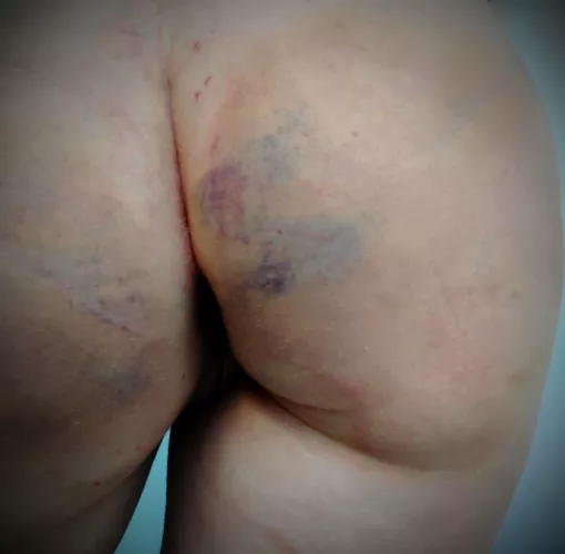 F24 I won’t break my chastity again anytime soon