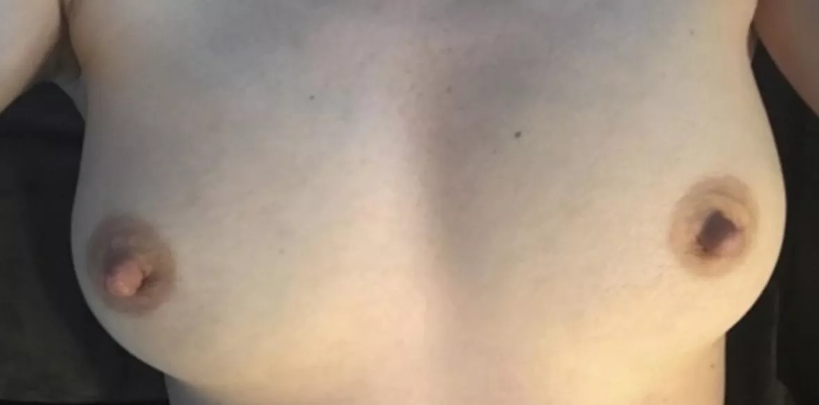 My super pale titties (F)