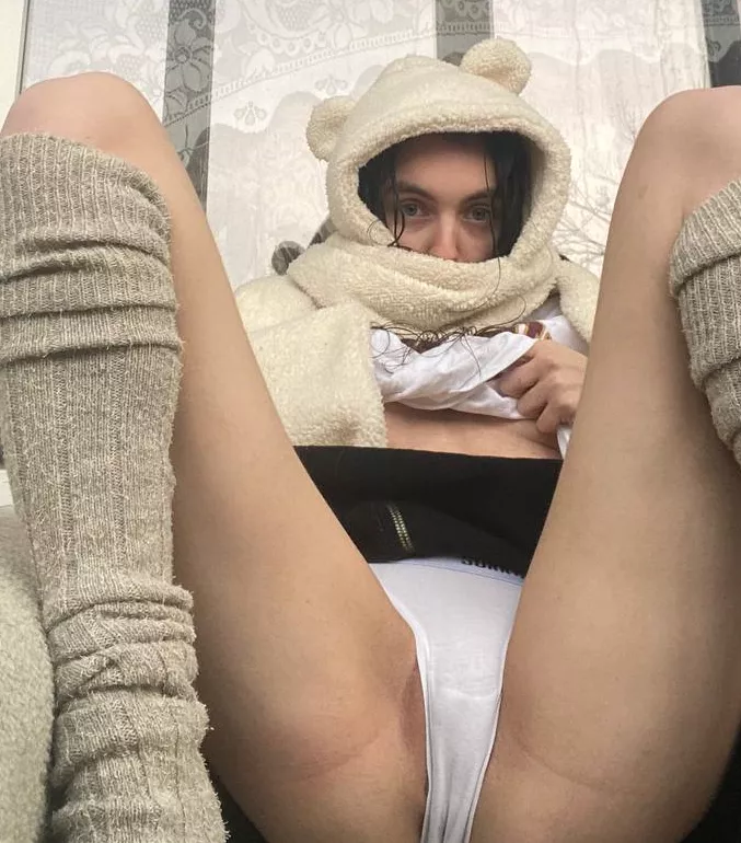 What about frontview