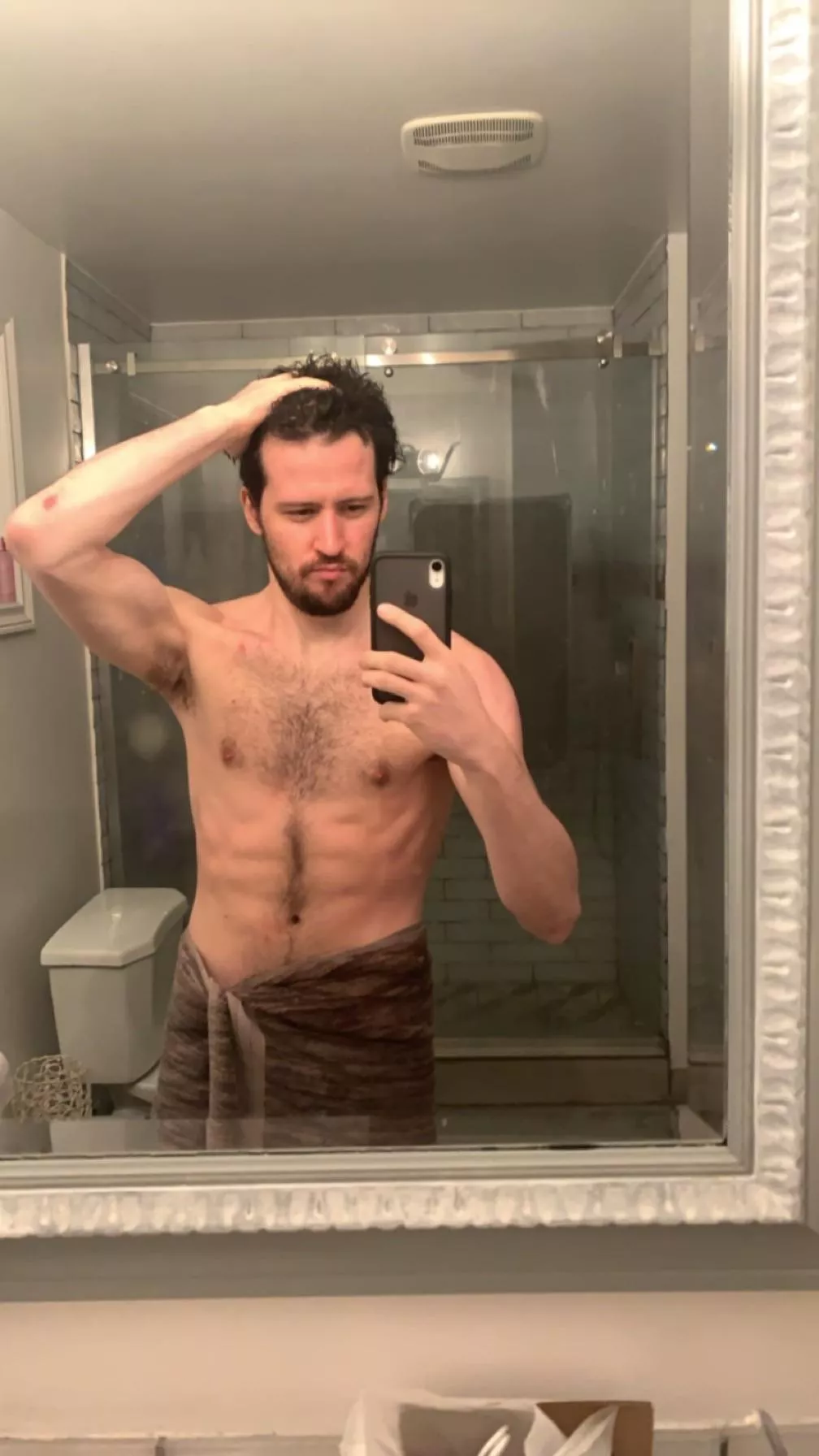 Little banged up from hockey but I can still go ;)